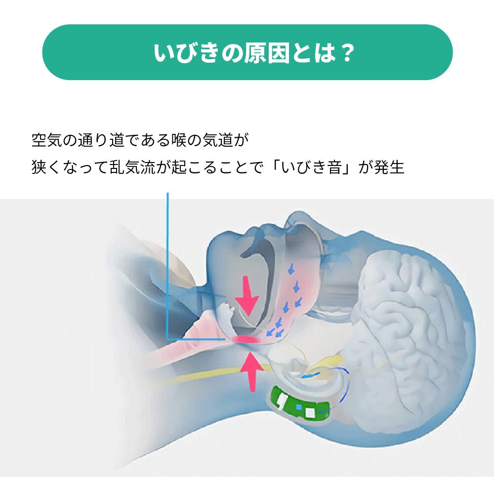 いびきの原因とは？
空気の通り道である喉の気道が狭くなって乱気流が起こることで「いびき音」が発生